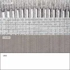 Stohovatelná venkovní židle s polstrovanými područkami H 73cm - Smart by Varaschin Viadurini